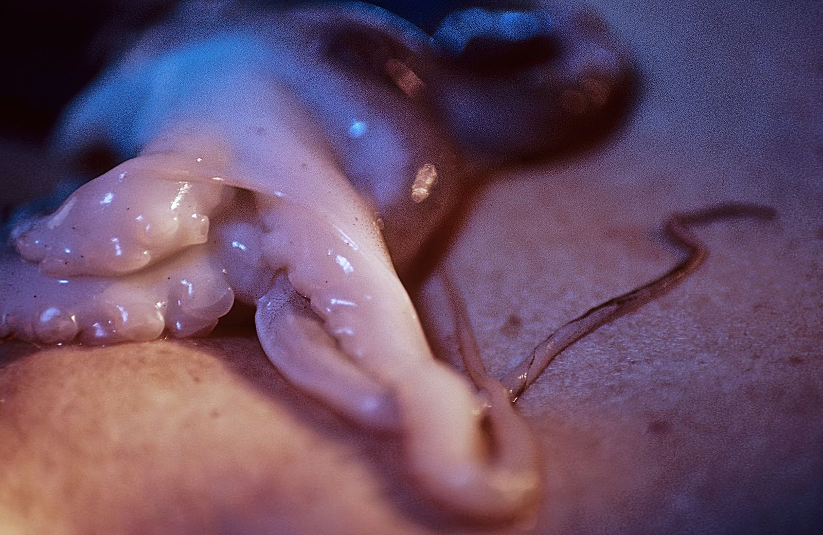 Octopus Skin